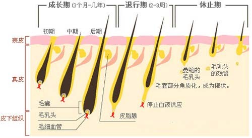 激光脫毛,808半導休脫毛機,永久脫毛,無痛脫毛