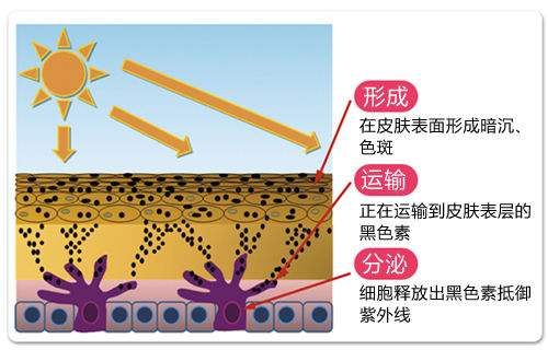 激光祛斑,美容儀器廠家,激光美容儀,操作美容儀器