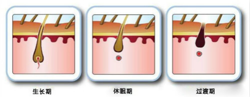 激光脫毛一次多少錢(qián)？能維持多久？