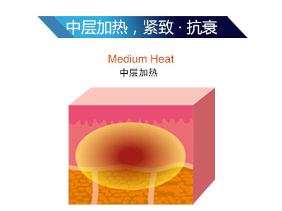 時光精雕儀是什么？為什么這么火