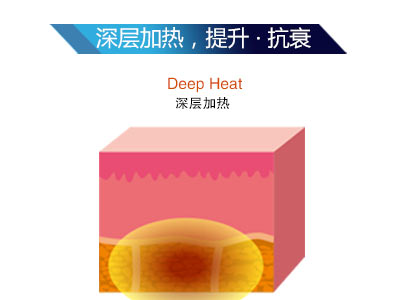 時光精雕儀是什么？為什么這么火