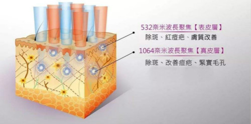 超皮秒比皮秒高大上？你怕是想多了