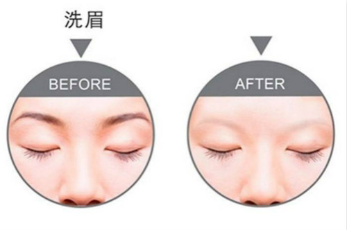 激光洗眉機怎么用？飄眉或霧眉失敗如何處理？