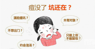 激光去痘印方法你適合嗎？