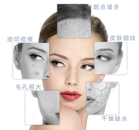 小氣泡美容儀怎么辨別品質(zhì)的優(yōu)劣呢？